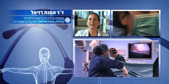 BeOK ד"ר אסנת רזיאל ניתוח שרוול קיבה